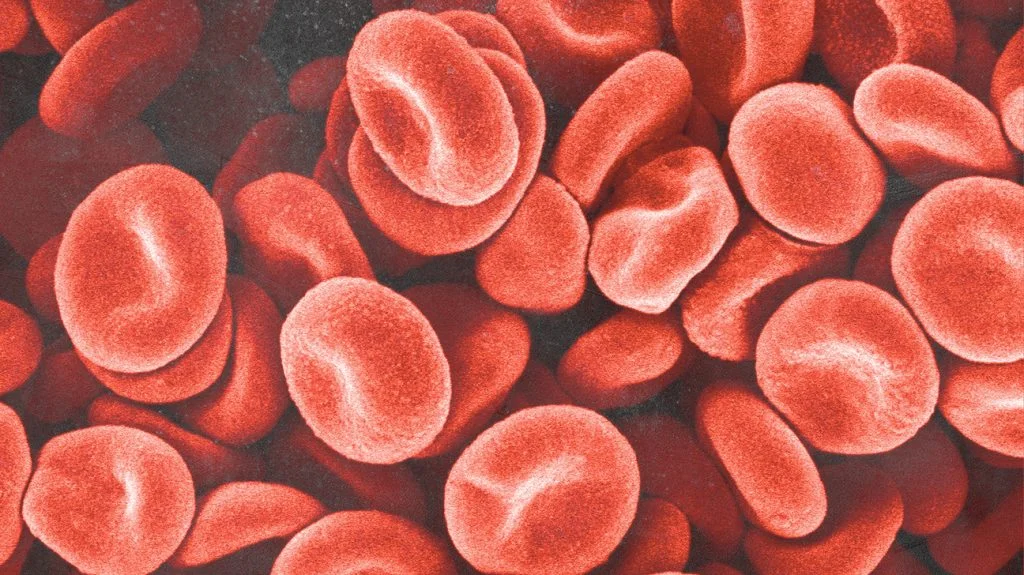 Gwada Negative blood group representative image