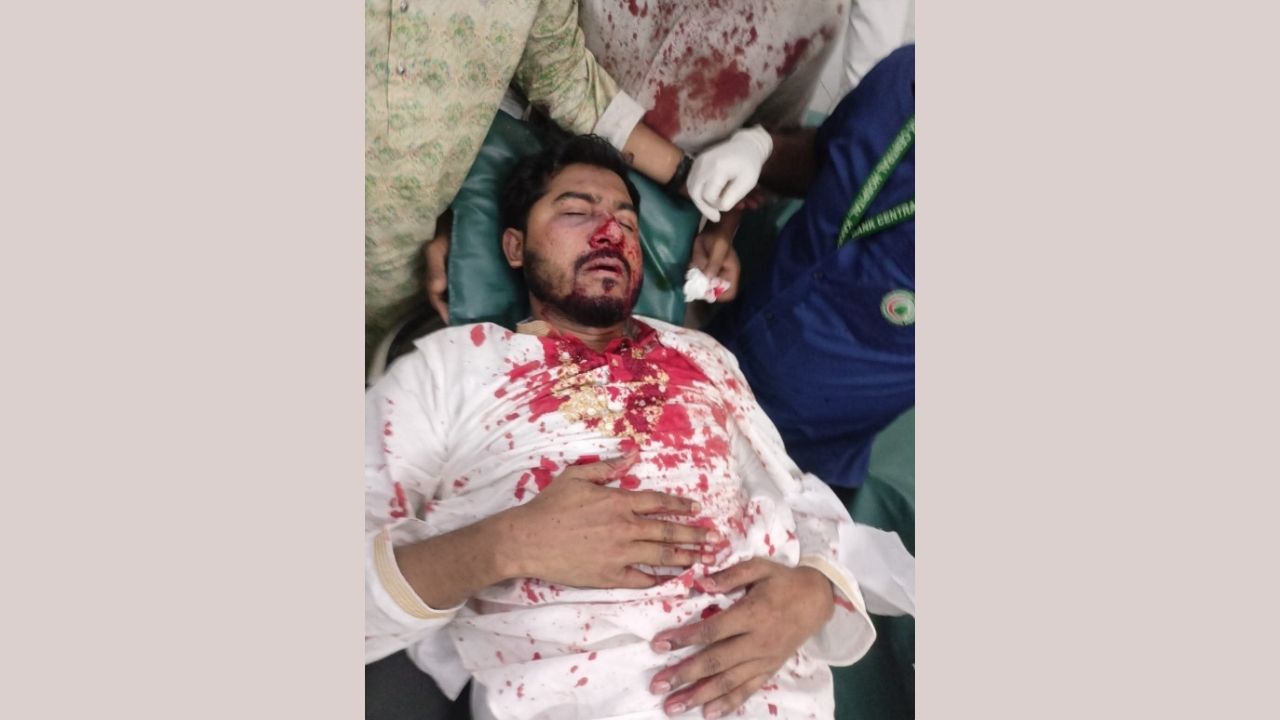 Nurul Haque Nur Injured