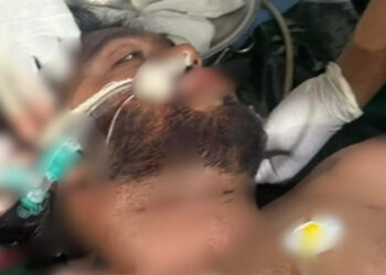 doctors reveal osman hadi's condition is critical