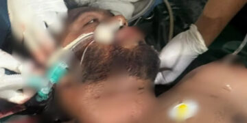 doctors reveal osman hadi's condition is critical