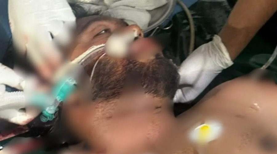 doctors reveal osman hadi's condition is critical