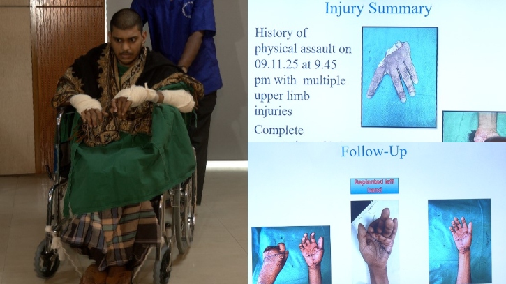 National Institute of Burn and Plastic Surgery